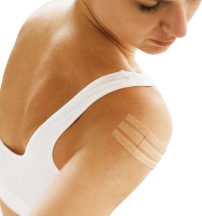 Produktbild 3M Nexcare Steri-Strips Wundverschlussstreifen (8 x)