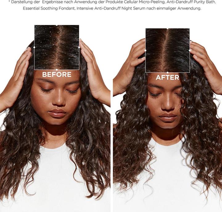 Actual product image Kérastase Symbiose Micro-Peeling Cellulaire (200 ml, Liquid shampoo)