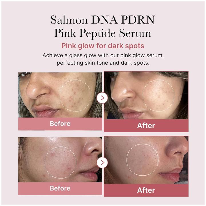 Produktbild Medicube PDRN Pink Peptide (30 ml)