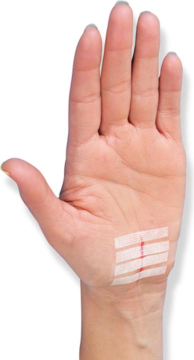 Produktbild 3M Nexcare Steri-Strips Wundverschlussstreifen (8 x)