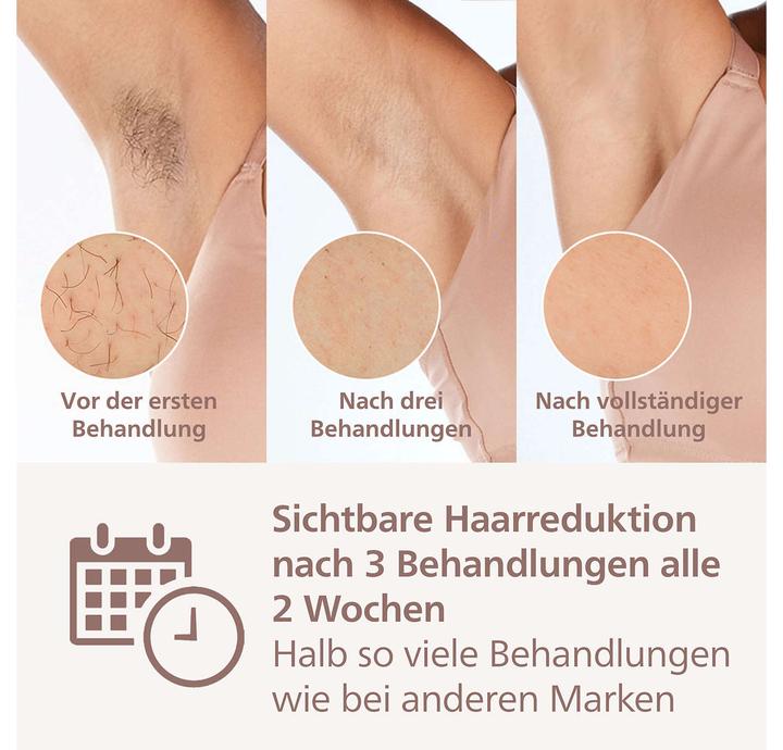 Image du produit Philips Lumea IPL Series 9000