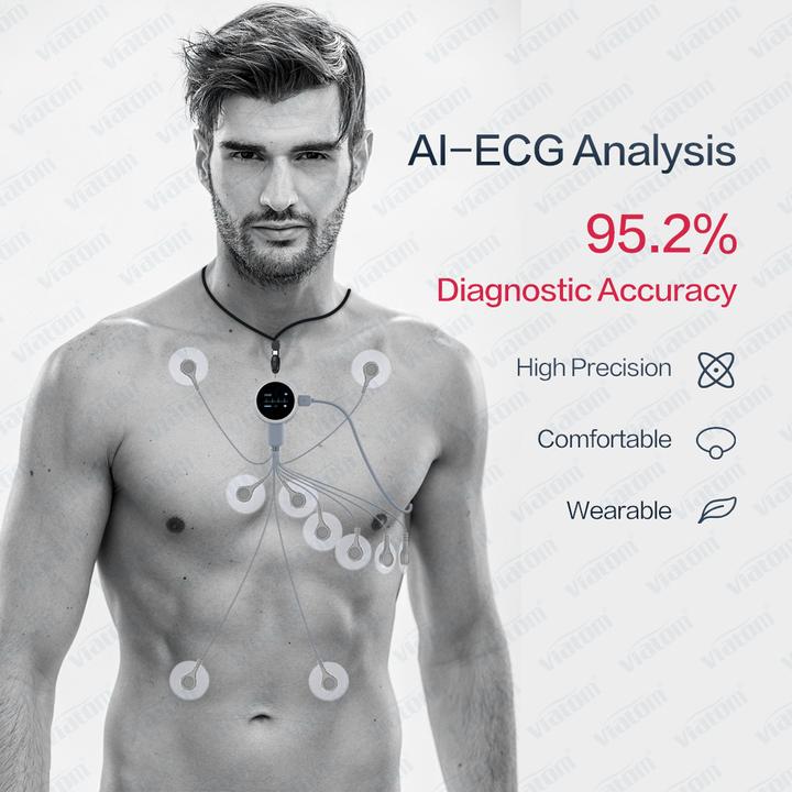 Actual product image ViatomTech Lepod Pro 12-lead 48Hrs Real-time ECG Recorder