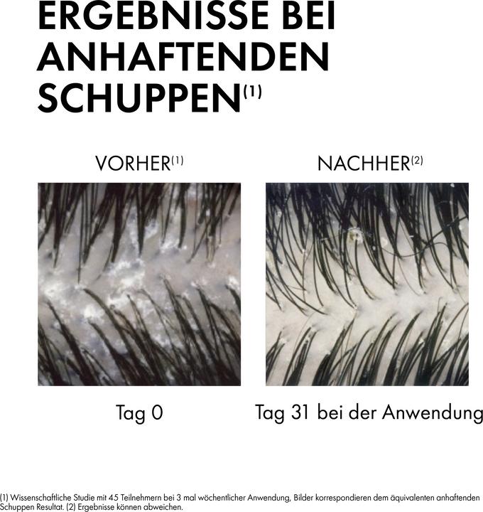 Image du produit Vichy Dercos Anti-Schuppen Shampoo für normale bis fettige Kopfhaut (500 ml, Shampoing liquide)