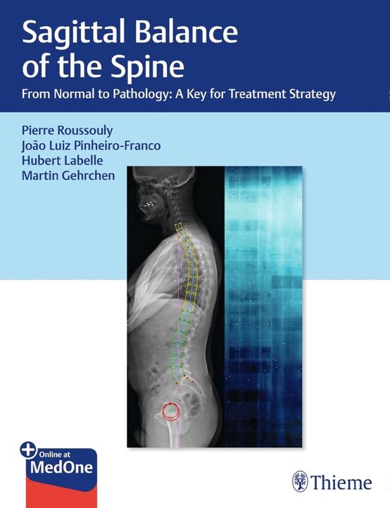 Produktbild Sagittal Balance of the Spine (Englisch, Thieme Publishers New York, 1. Edition (23. Oktober 2019), 2019)