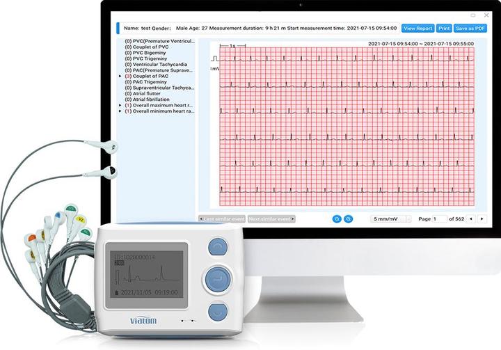 Actual product image ViatomTech TH12 Wearable 12-Lead holter with AI analysis