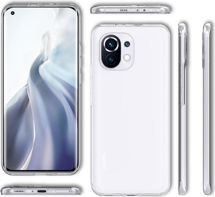 Produktbild Nalia Klare 360 Grad Hülle (Xiaomi Mi 11 5G)