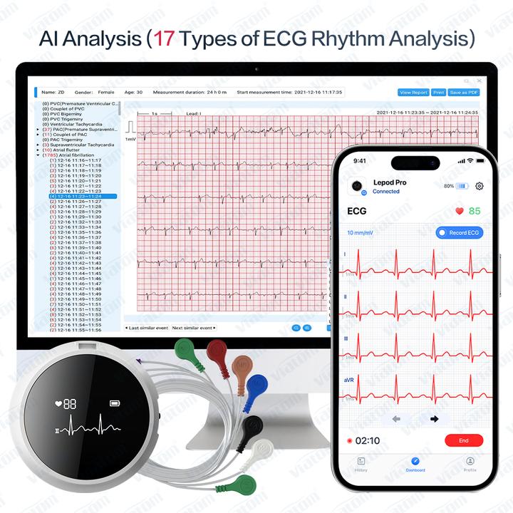 Actual product image ViatomTech Lepod Pro 12-lead 48Hrs Real-time ECG Recorder