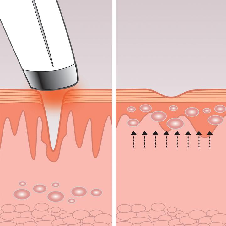 Produktbild Homedics Eye-200