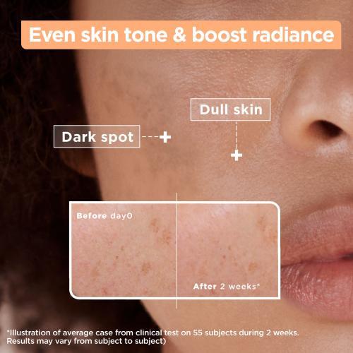 Actual product image Mixa Anti-Dark Spot (30 ml)