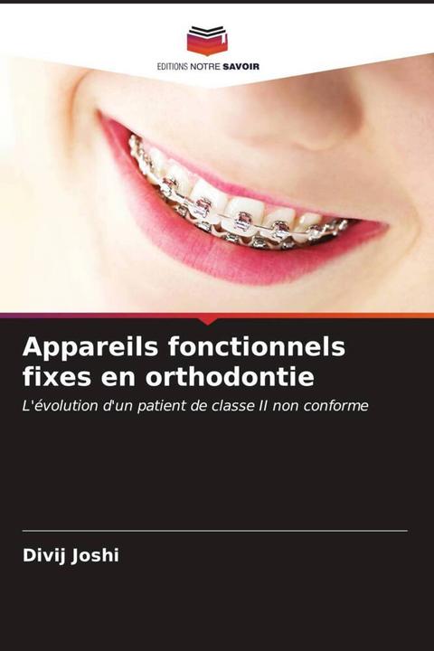 Produktbild Appareils fonctionnels fixes en orthodontie (Divij Joshi, 2023)