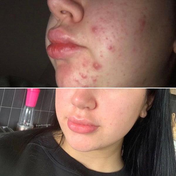 Produktbild Eco by Sonya Super Acai Exfoliator - Intensives Peeling (Peeling, 100 ml)