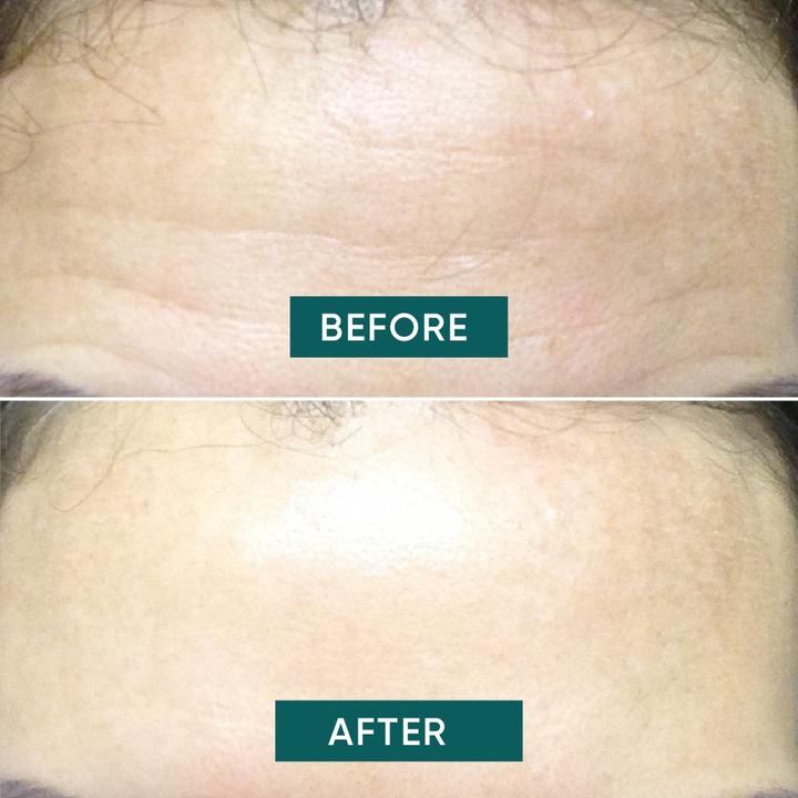 Actual product image Apricot Anti-ageing pad