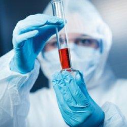 Produktbild Hygostar Chemikalien-Schutzhandschuh SUPER HIGH RISK, M (M)
