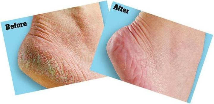 Image du produit O'Keeffe's Crème pour les pieds Healthy Feet (Bain de pieds)