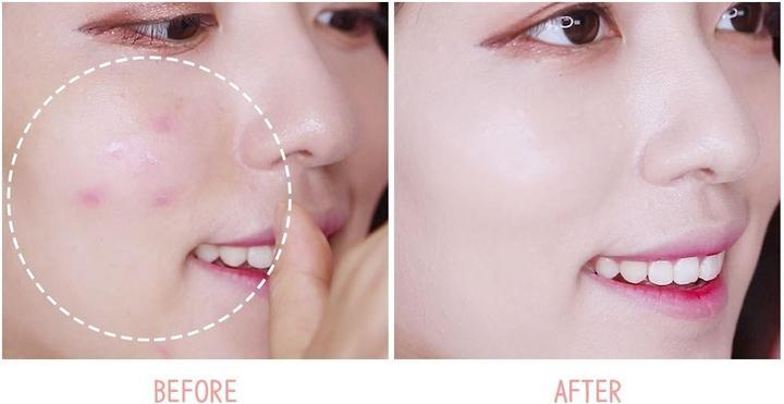 Actual product image Dr. Althea Aurora Cover Cushion + Refill SPF50+PA+++ (21 Bright)