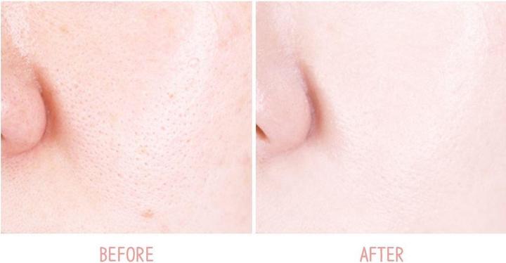 Actual product image Dr. Althea Aurora Cover Cushion + Refill SPF50+PA+++ (21 Bright)