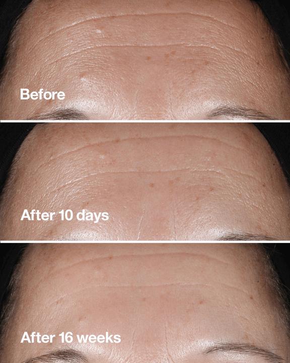Actual product image Clinique Smart Custom-Repair Serum (50 ml)