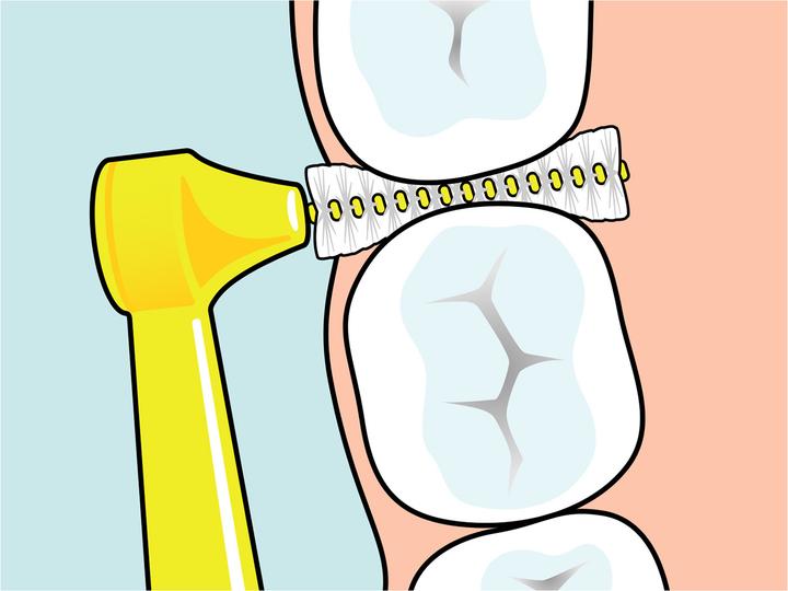Actual product image TePe Interdental brushes Angle ISO 0 (6 x, 0.40 mm)