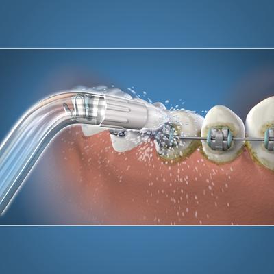 Immagine prodotto Waterpik Ortodonzia (Accessori per irrigatori orali)