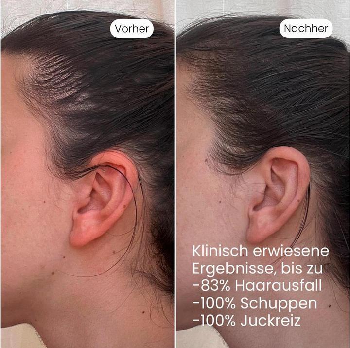 Immagine prodotto Vedic Lab Tages-Kopfhaut-Elixier +UV 100 ml (100 ml)