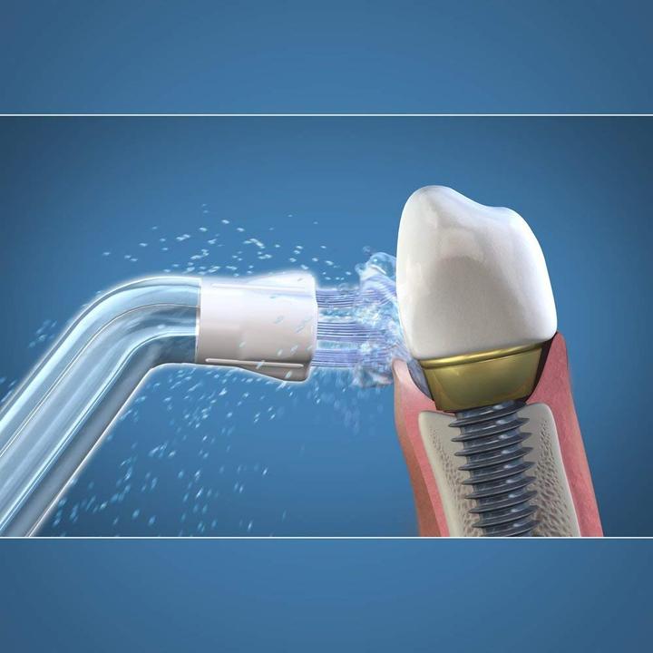 Image du produit Waterpik Chercheur de plaque PS-100 (Embouts de douches buccales)