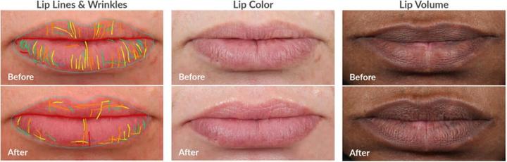 Actual product image PMD Kiss Lip Plumping System