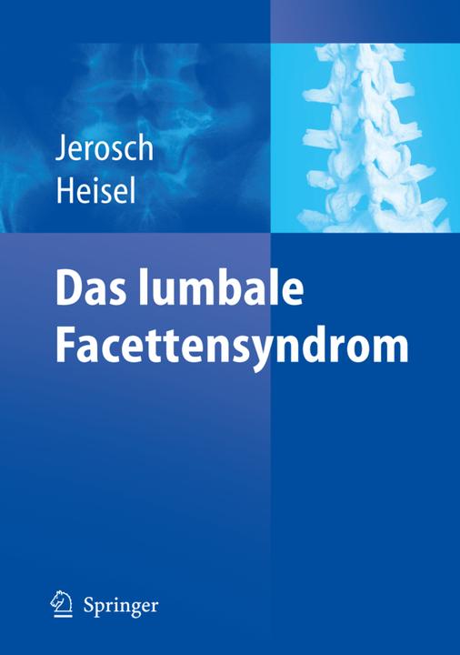 Produktbild Das lumbale Facettensyndrom (Deutsch, Jörg Jerosch, Jürgen Heisel, 2006)