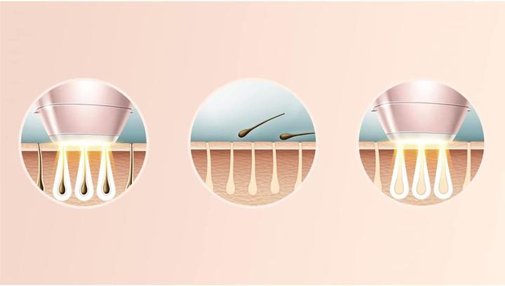 Produktbild Philips Lumea Prestige