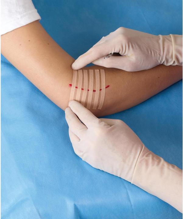 Produktbild Nexcare Steri-Strip Wundverschlussstreifen (6 x)
