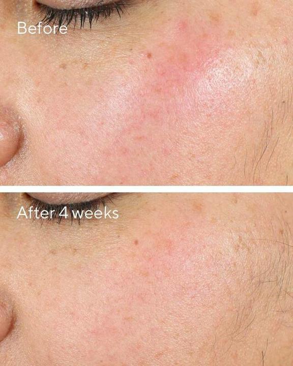 Actual product image Murad 15293 Day / Night Cream Women All ages 50 ml (50 ml)