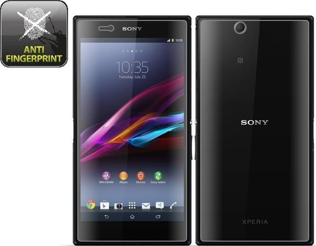 Actual product image Protectorking 6x Displayschutzfolie matt Anti-Reflex entspiegelt (6 Piece, Sony Xperia Z Ultra)