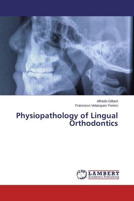 Actual product image Physiopathology of Lingual Orthodontics (German, Francisco Velasquez Forero, Alfredo Gilbert, 2014)