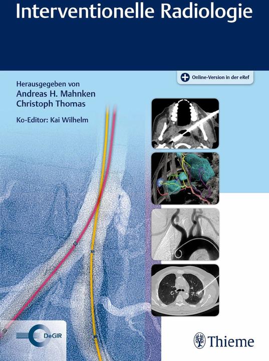 Immagine prodotto Interventionelle Radiologie (Tedesco, Christoph Thomas, Andreas H. Mahnken, 2019)