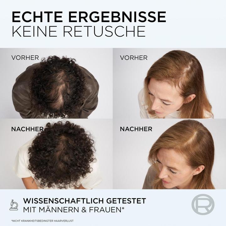 Produktbild L'Oréal Paris Elseve (150 ml)