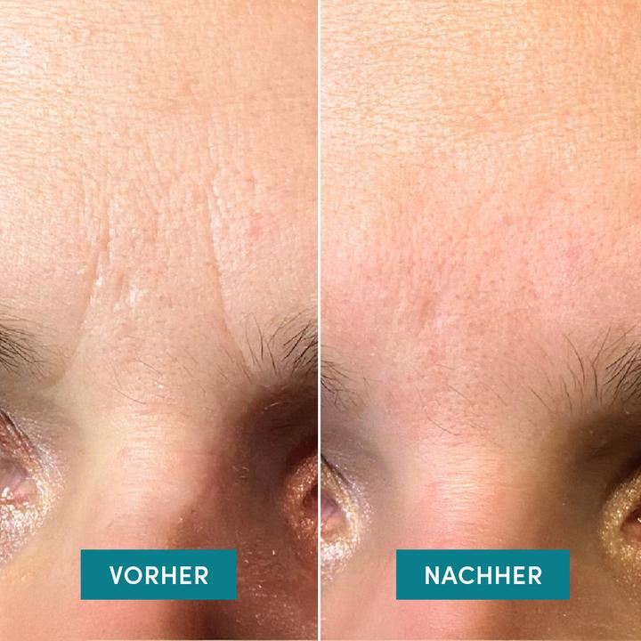 Actual product image Apricot Face Patches Ectoin „face charmer“