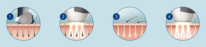 Image du produit Philips Lumea pour hommes