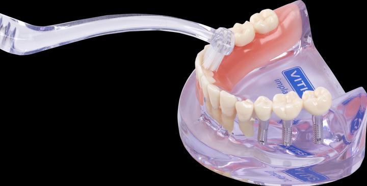 Actual product image Dentaid Vitis Implant Angular (1 x)