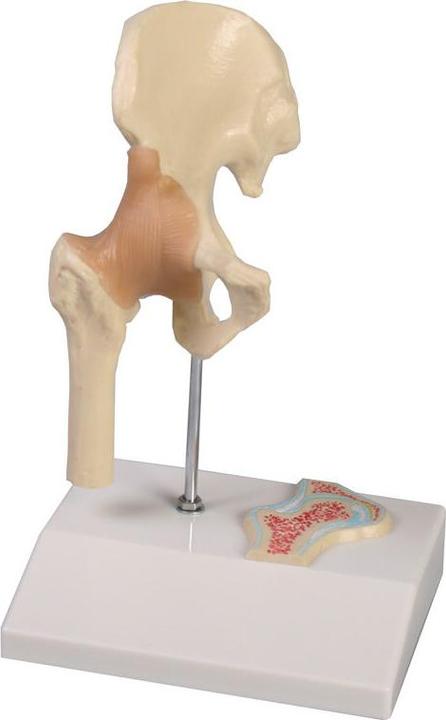 Image du produit Erler Zimmer Modèle de mini-articulation de la hanche avec coupe transversale