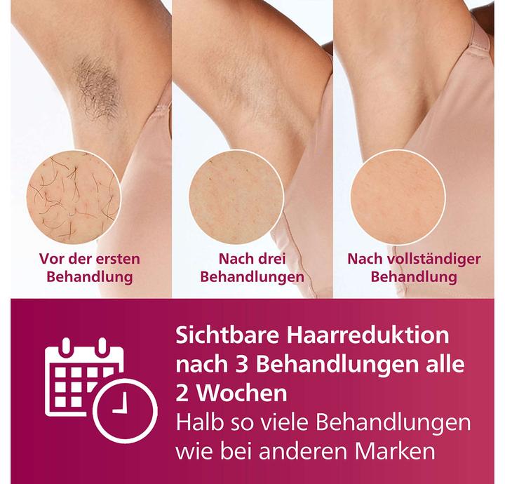 Produktbild Philips Lumea Advanced BRI920/00
