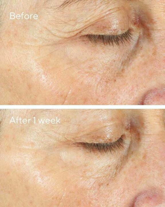 Actual product image Murad 15293 Day / Night Cream Women All ages 50 ml (50 ml)