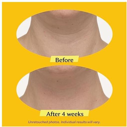 Image du produit StriVectin Tighten&Lift (50 ml, Crème de jour, Jusqu'à SPF 10)