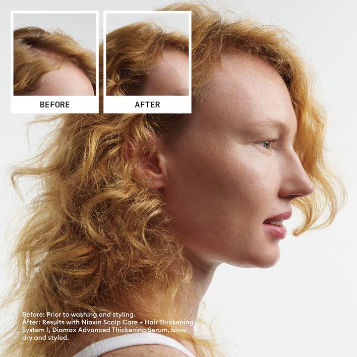 Actual product image Nioxin Scalp + Hair Thickening System 1 (350 ml)