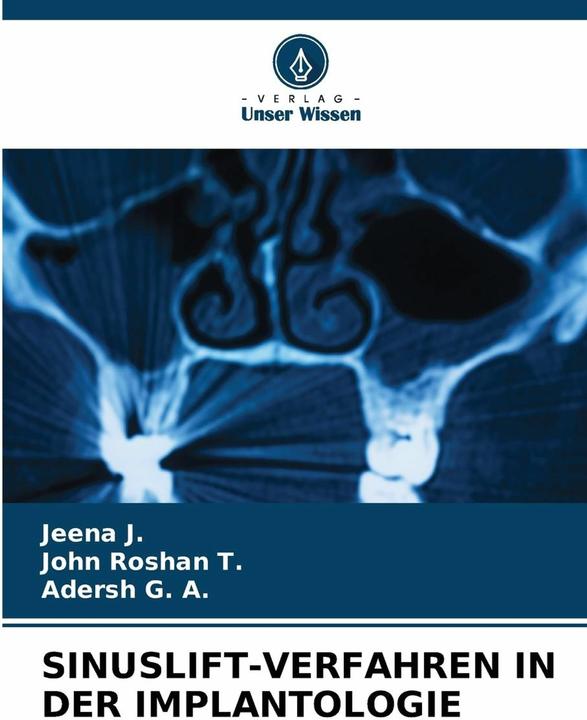 Produktbild Sinuslift-Verfahren In Der Implantologie (Deutsch, Jeena J., John Roshan T., Adersh G. A., 2024)