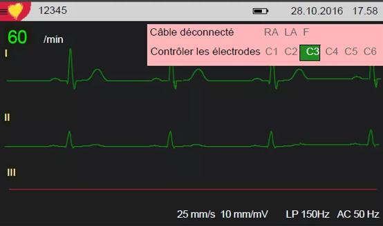 Immagine prodotto ECG a riposo Cardiovit AT-1 G2 con opzione di interpretazione