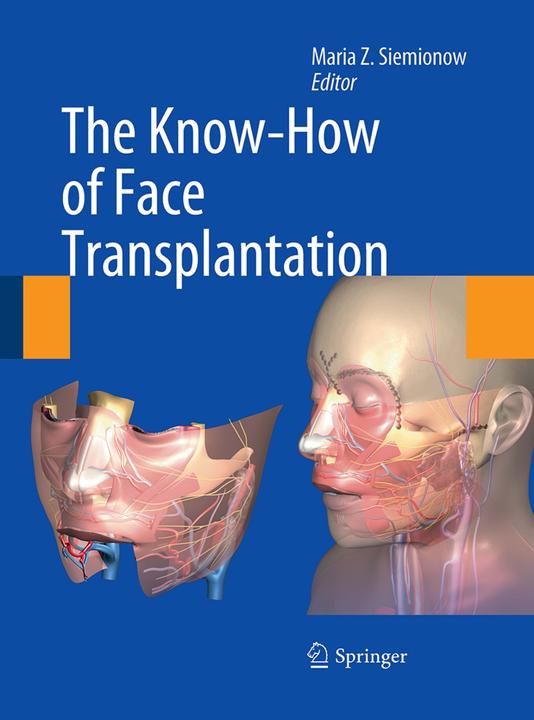Produktbild The Know-How of Face Transplantation (Maria Z. Siemionow, 2016)