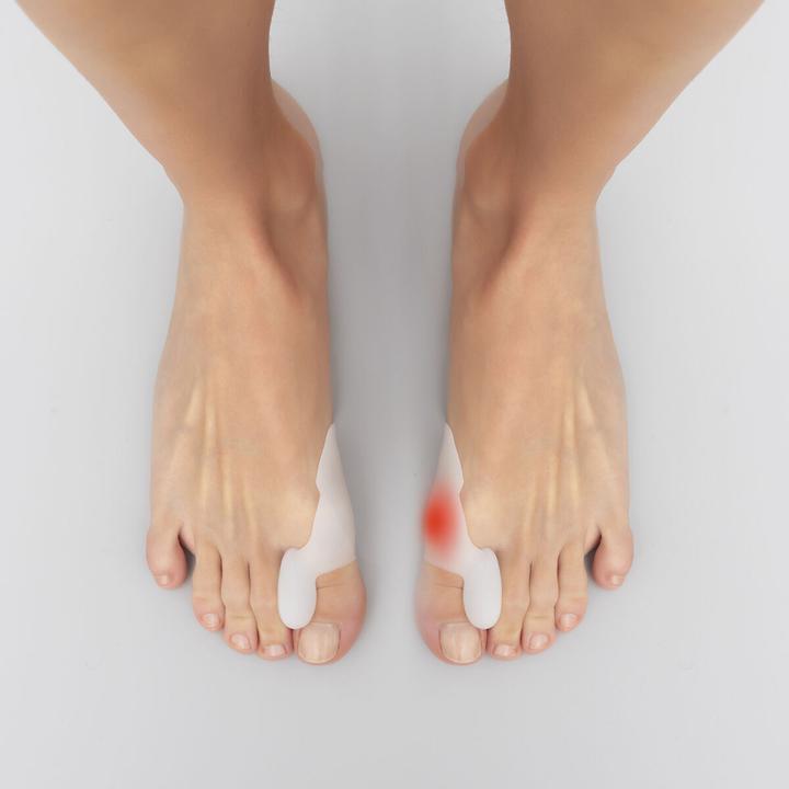 Immagine prodotto InnovaGoods Cuscinetti in silicone per calli Bunilief confezione da 2 unità (Decompressione)