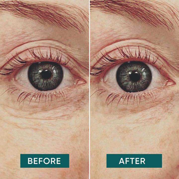 Produktbild Apricot Eye Pads Hyaluron