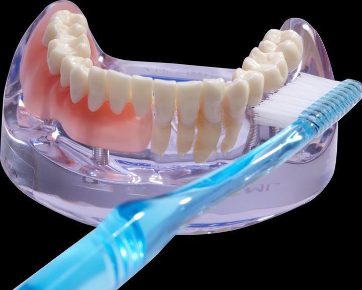 Actual product image Vitis implant Sulcus toothbrush Toothbrush (1 x)