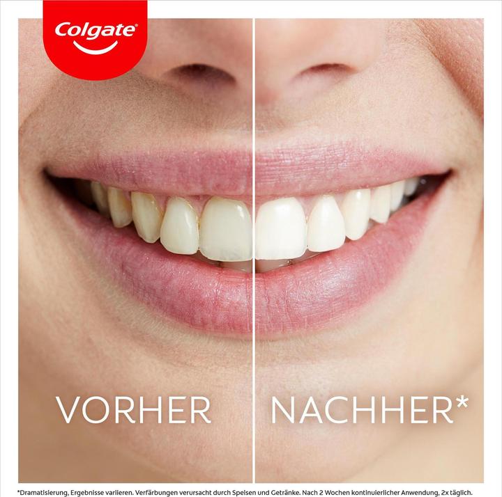 Immagine prodotto Colgate Kit sbiancante Max White Ultim (Luce LED)