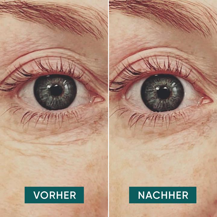 Image du produit Apricot coussinets réutilisables anti-rides pour les yeux avec hyaluron (Patchs)